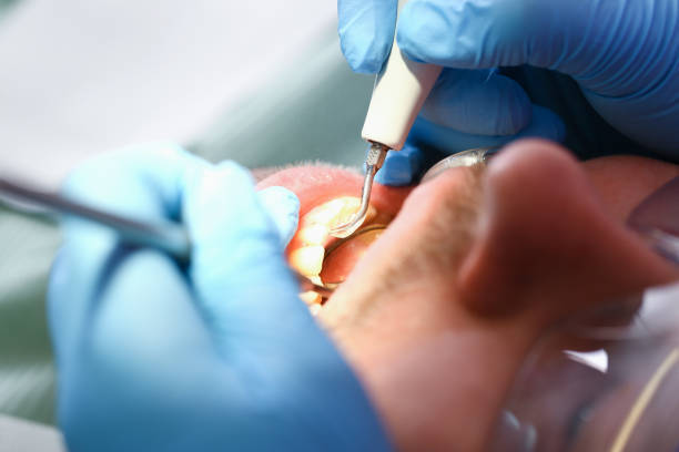 Best Holiday Emergency Dentist in Rosebud, TX