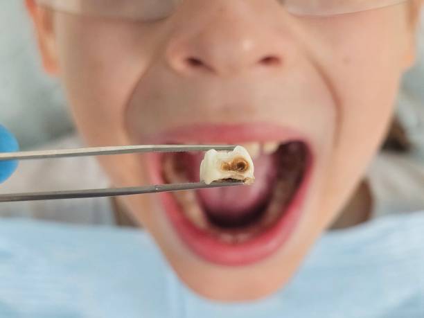 Best Emergency Dentist for Special Needs Patients in Rosebud, TX